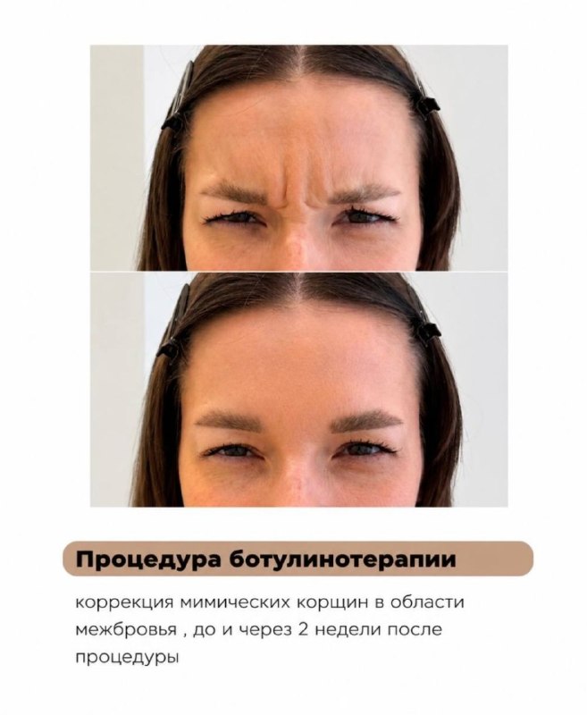 Косметологические процедуры